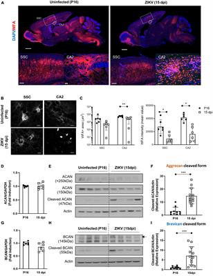 Neonatal Zika virus infection causes transient perineuronal net degradation